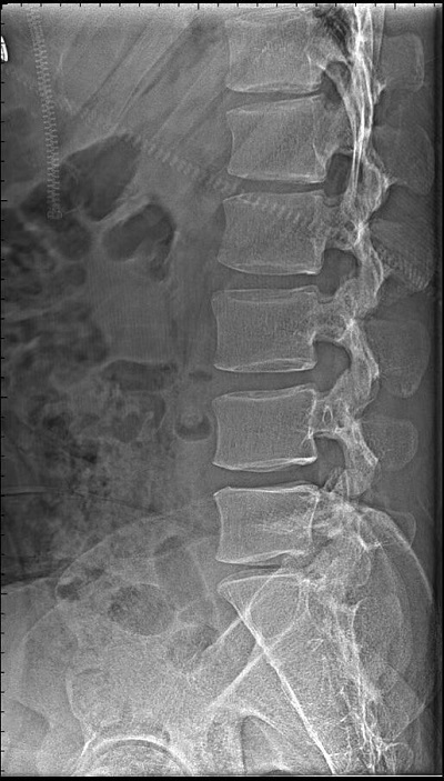 怎么才能選購(gòu)好醫(yī)用高清攝像機(jī)